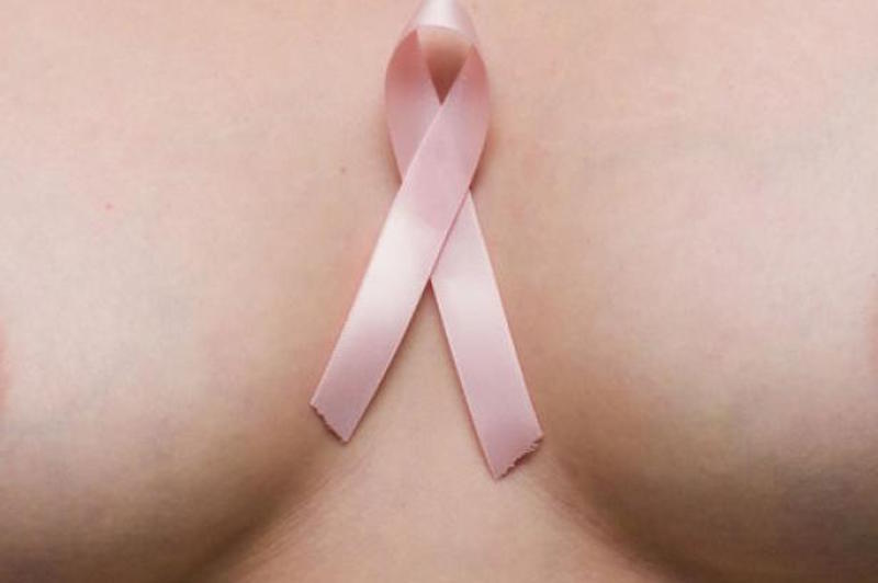 première-mammographie-blog-02-2016-2